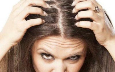 Calvicie en las mujeres