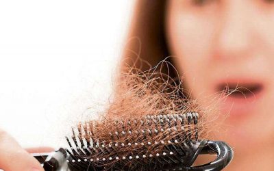 Caída del cabello en la menopausia