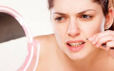 Preguntas sobre la depilación láser facial femenina