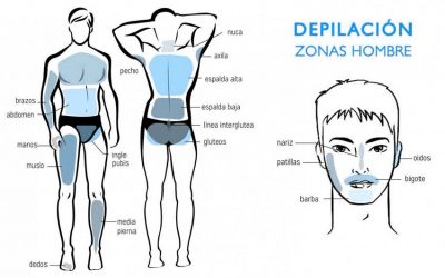 Zonas de depilación láser en hombres