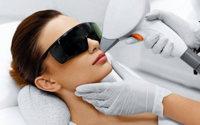 Depilación láser facial